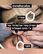 אורטל הר זהב