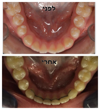 ד"ר דיאמנט יוליה