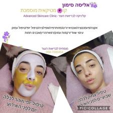 אליסה סימון אסתטיקס